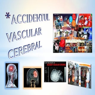 Accidentul vascular cerebral.....