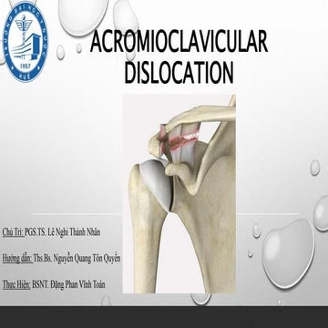 Ac dislocation dangtoandhy