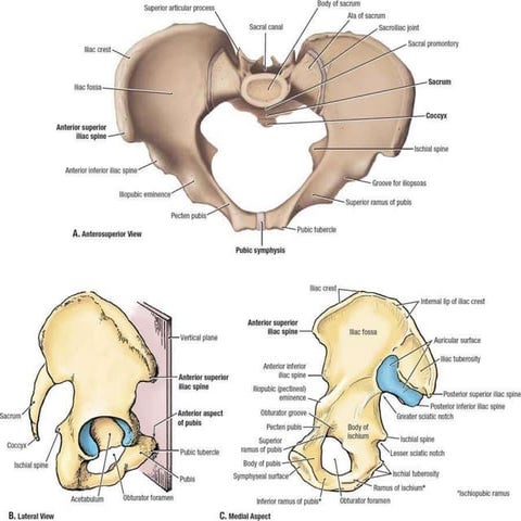 Acetabular fracture