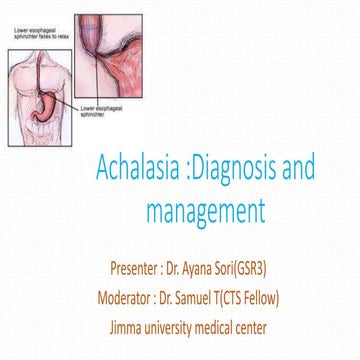 Management Of Achalasia | Diagnosis and Management of Achalasia – XICGLX
