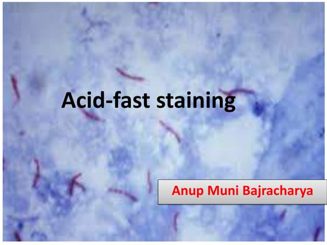 Acid fast staining 