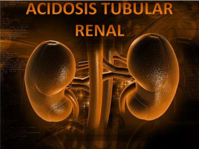 Acidosis tubular renal tipo 2 y 4