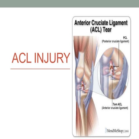 ACL.injury.final year.pptx