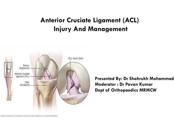 Anterior Cruciate ligament Injury | PPT