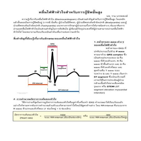 EKG in ACLS