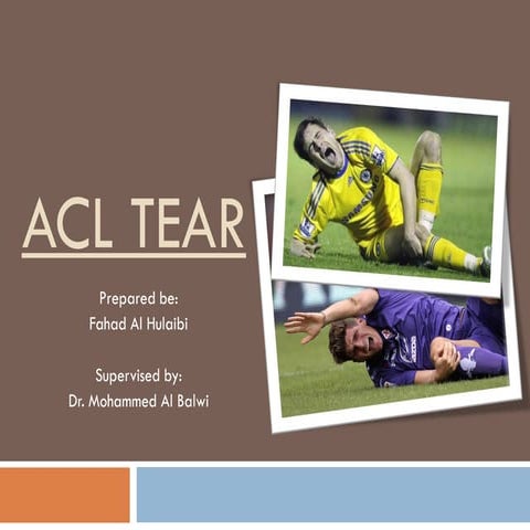 ACL tear
