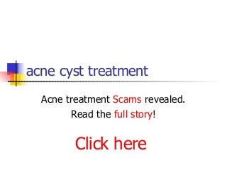 acne cyst treatment