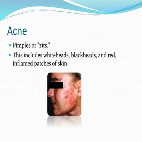 combo ppt | PDF