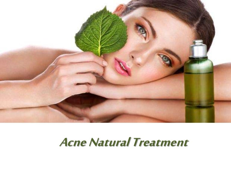 Acne Natural Treatment