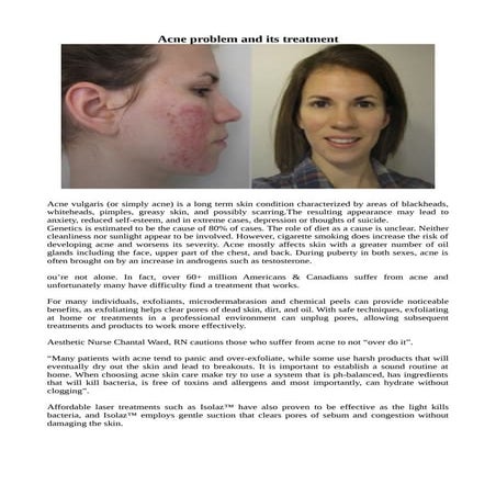 Acneproblem | PDF