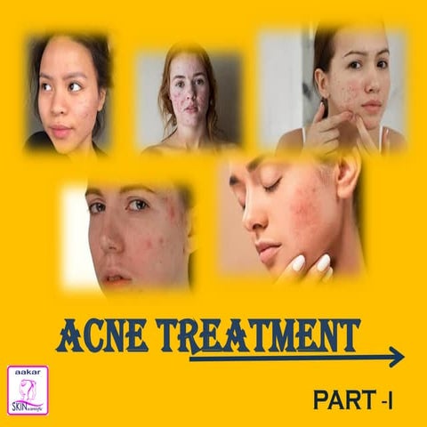 Acne treatment part I | PPT