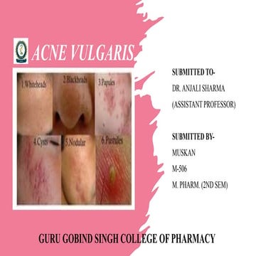acne vulgaris -Mpharm (2nd semester) Cosmetics and cosmeceuticals