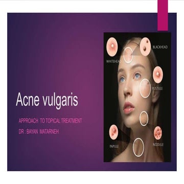 Acne vulgaris approach to topical treatment