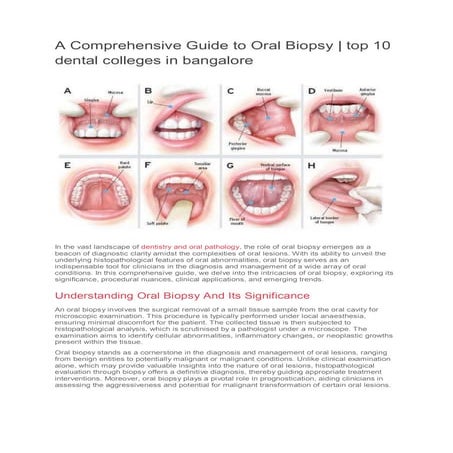 Comprehensive Guide to Tissue Grossing in Oral Pathology for Accurate ...