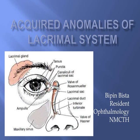 Acquired anomalies of lacrimal system