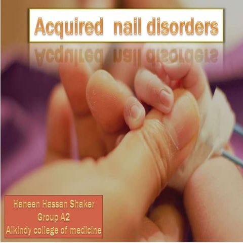Acquired nail dis part