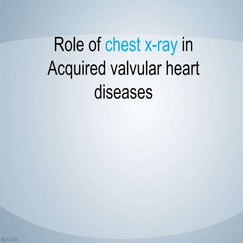 Acquired valvular heart diseases with x ray findings