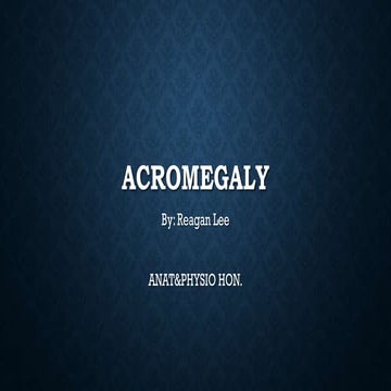 Acromegaly