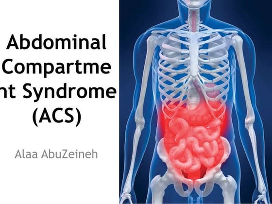 WSACS Recommendations | PPT