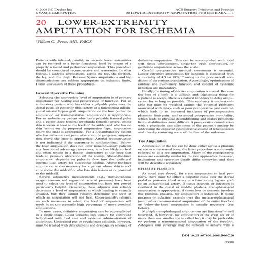 Acs0620 Lower Extremity Amputation For Ischemia | PDF