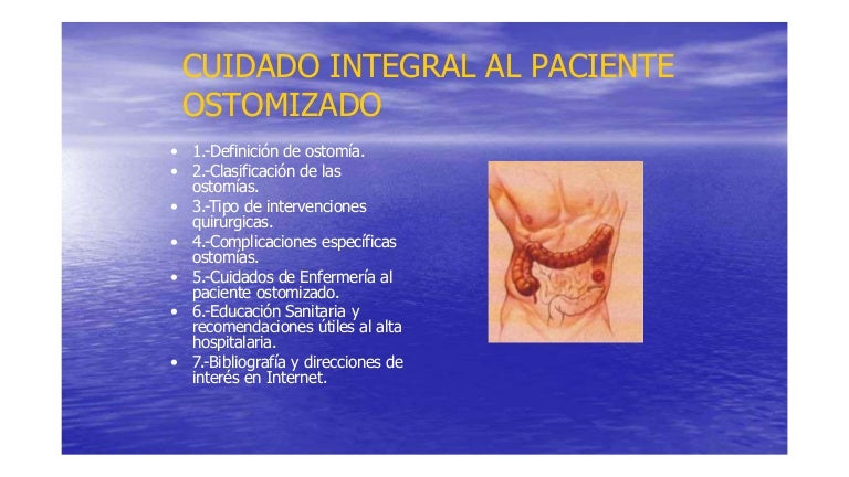 Ostomías. Cuidados de Enfermería,