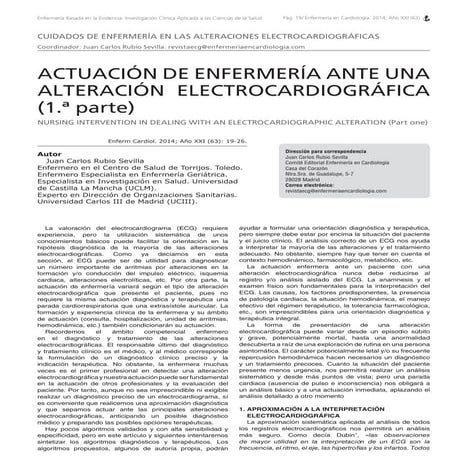 Actuación de enfermería ante una alteración electrocardiográfica (1º parte)