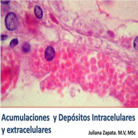 Acumulaciones  y depósitos intracelulares y extracelulares aut