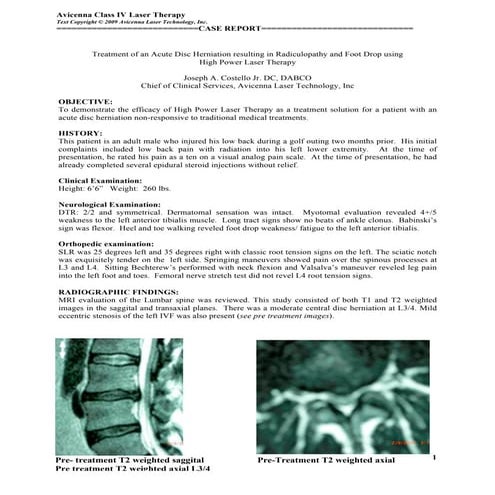 Acute Disc Herniation with Foot Drop Case Study—AvicennaLaser.com