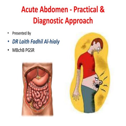 Acute abdomen   a practical approach