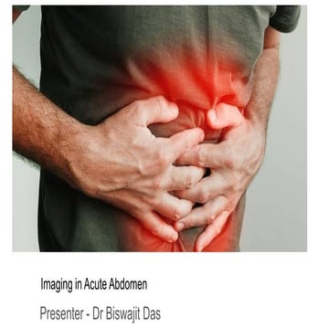 Acute abdomen radiological features and differential diagnosis