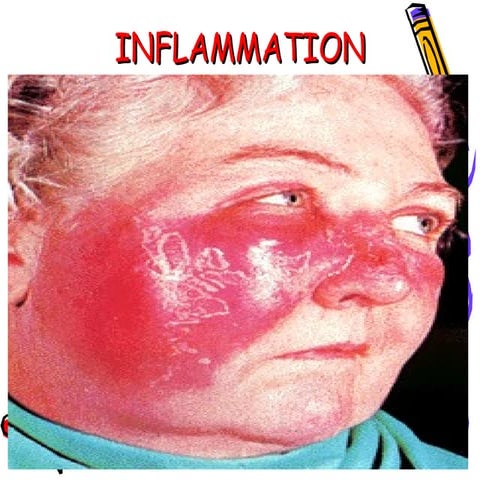 Acute_and_Chronic_Inflammation_-_Copy.ppt