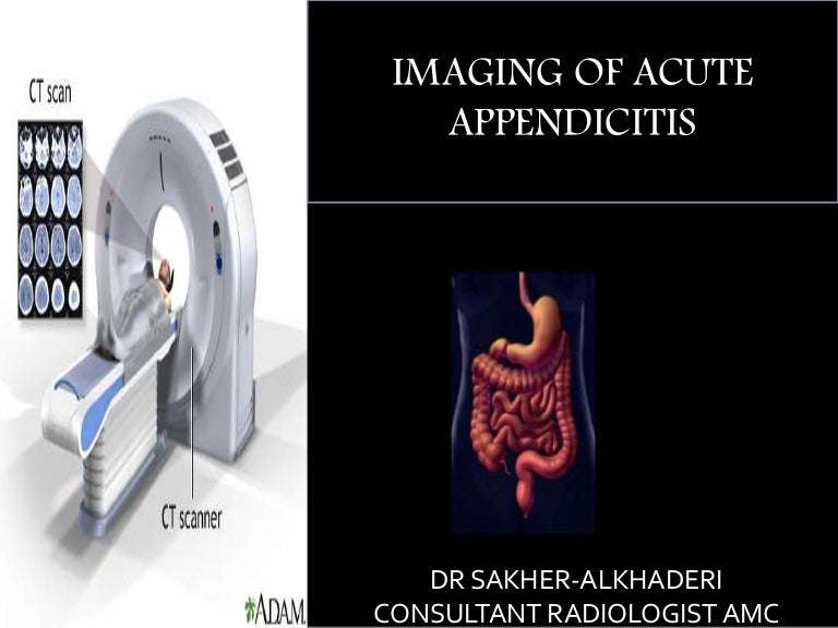 Practical Imaging Strategies For Acute Appendicitis In Children – KIYVHO