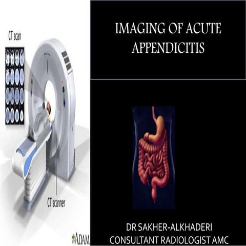 Imaging of Acute Appendicitis 