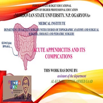 acute appendicitis surgery(аппендицит).pptx