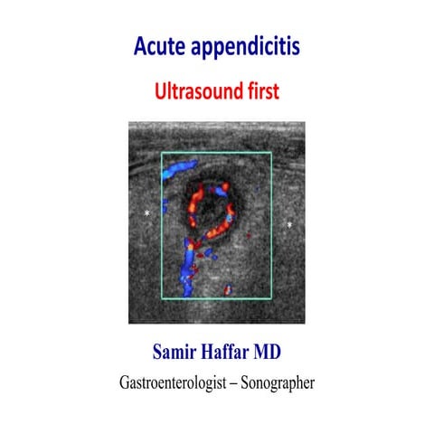 Acute appendicitis  - Ultrasound first