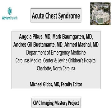 Acute Chest Syndrome - EMGuidewire's Radiology Reading Room