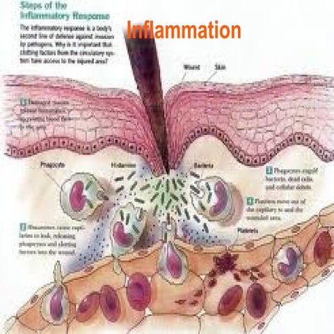 Patho inflammation | PPTX