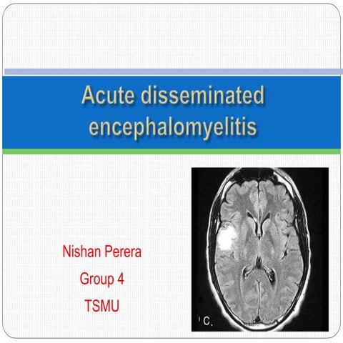Acute Disseminated Encephalomyelitis 