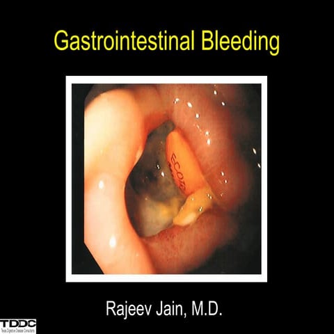 Acute Gastrointestinal Bleed Management.pptx