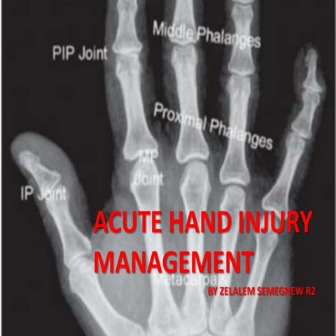 Acute hand injury management 