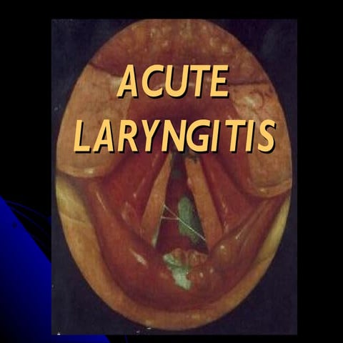 E.N.T.Acute laryngitis.(dr.usif chalabe)