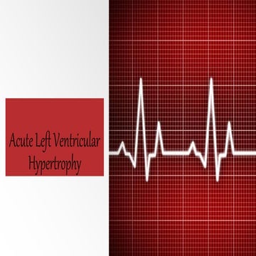 Right and left ventricular hypertrophy | PPT