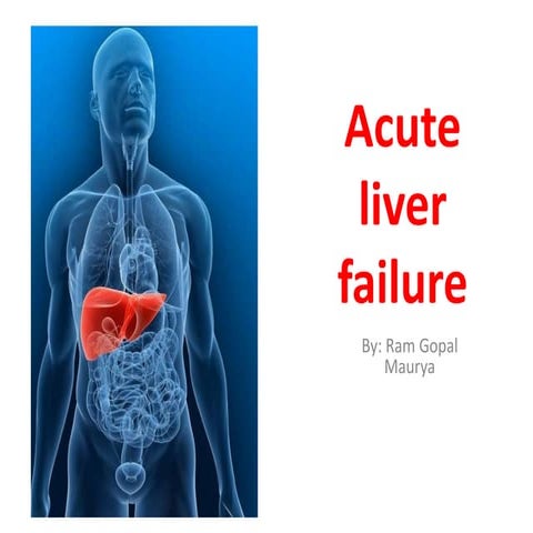 Acute liver failure