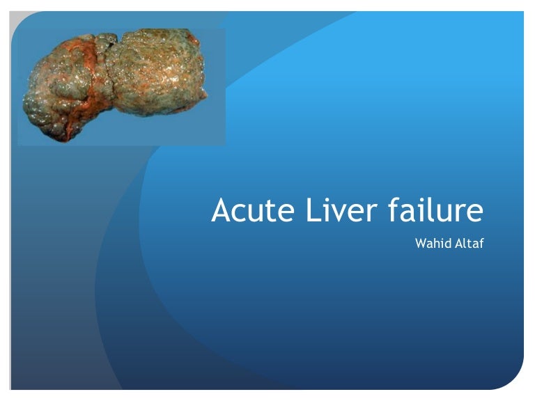 Acute liver failure in icu