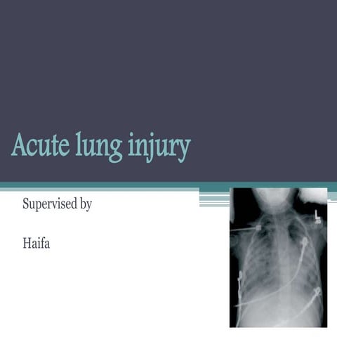 Acute lung injury 