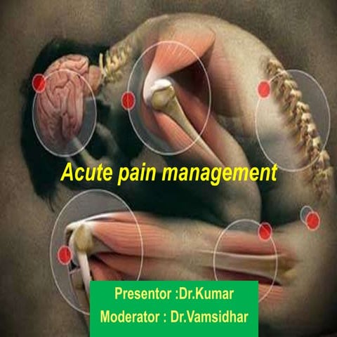Acute pain and its management