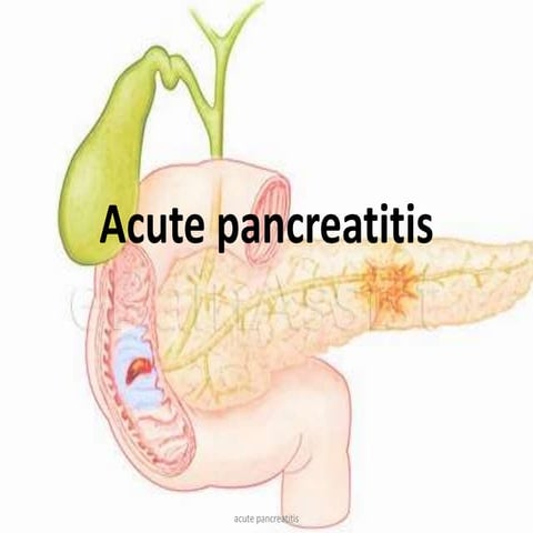 acute pancreatitis