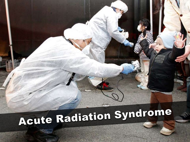 Acute radiation syndrome prodromal phase