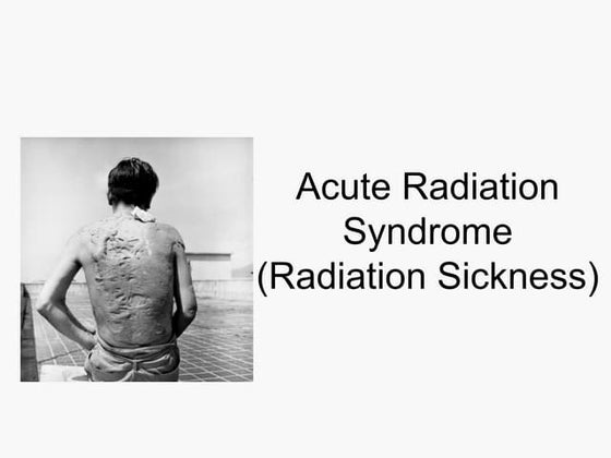 Radiation sickness | PPTX