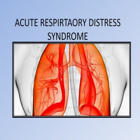 Acute Respirtaory Distress Syndrome